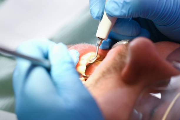 Best Orthodontic Emergency Dentist in Lake Forest, CA