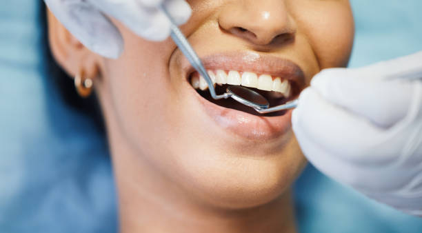 Best Emergency Dentist for Lost Fillings or Crowns in Lake Forest, CA