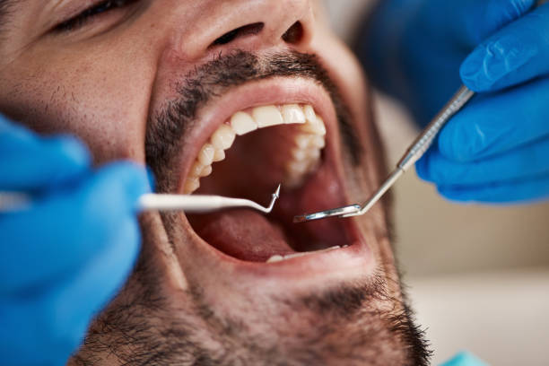 Best Pediatric Emergency Dentist in Lake Forest, CA